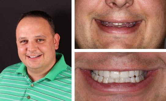 Orthodontic Treatment in Boulder, Co | Orthodontists