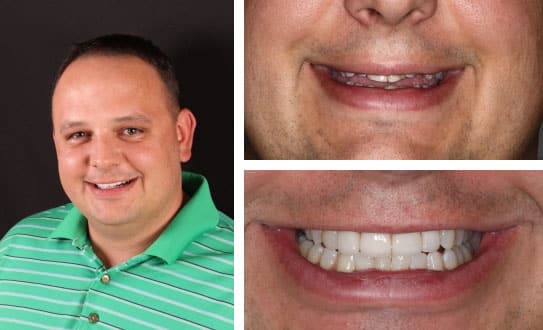 Neuromuscular Orthodontics in Denver, CO