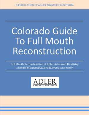 guide.full .mouth .reconstruction.denver.boulder.colorado Page 01