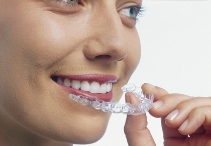 putting in invisalign clear braces near Boulder CO