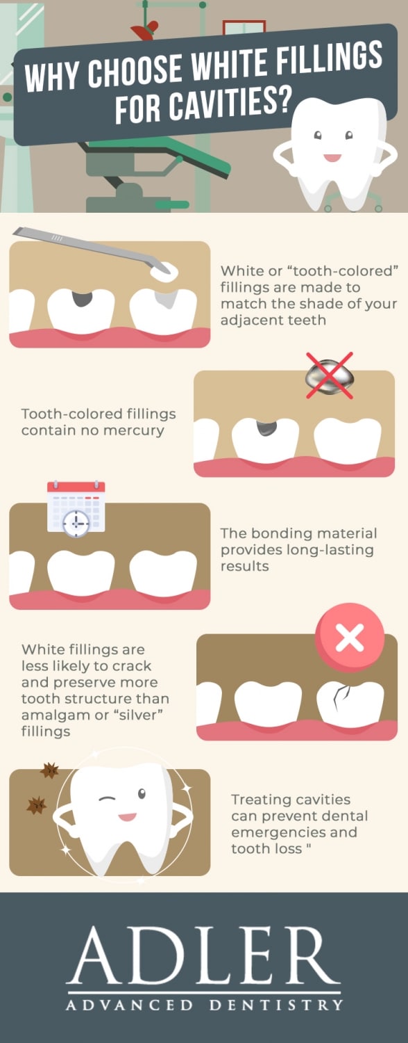 white fillings boulder dentist cavity