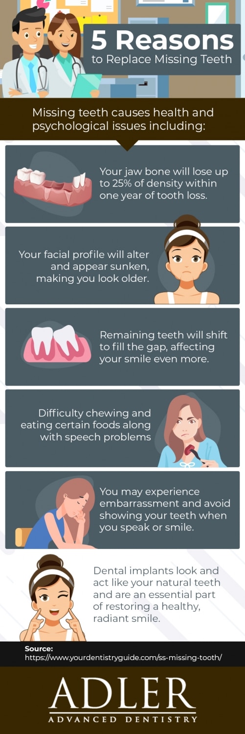 Inforgraphic goes over what happens to your oral health when you lose a tooth.