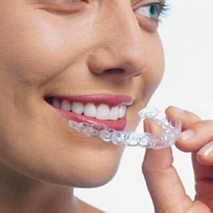 Boulder Invisalign dentist