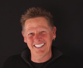 patient smile after by Boulder Colorado cosmetic neuromuscular dentist Michael Adler