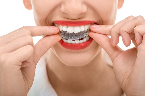 invisalign clear braces benefits boulder colorado cosmetic dentist