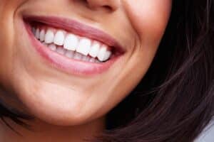 Close up of stunning smile after gum recontouring in Boulder, CO