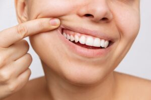 Woman showing her healthy gums after gum disease treatment in Boulder, CO